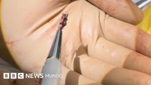"Me sacaron metralla del corazón": los imanes con los que se salvan vidas en la guerra en Ucrania