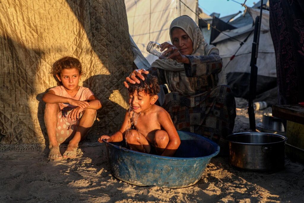 Muere otro bebé por desnutrición en Gaza y se eleva el número total de muertes por hambre a casi 125