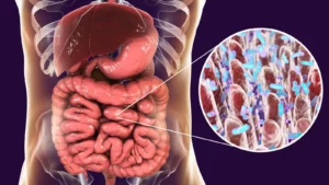 el 76% de los casos estarán relacionados con una infección común que se puede prevenir