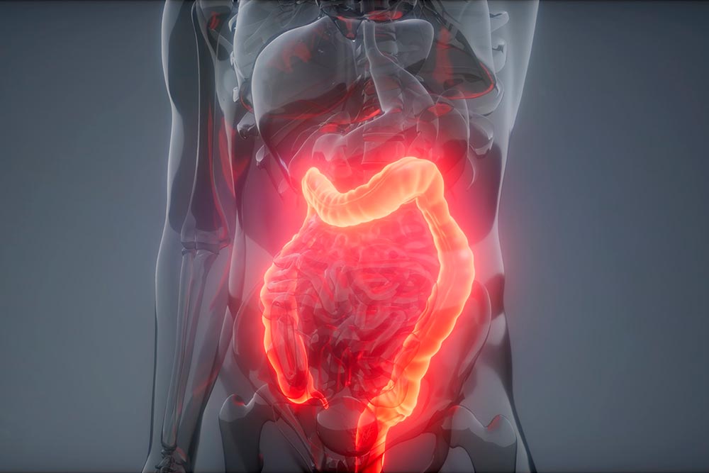 un trastorno común que limita vida social, según gastroenterólogo