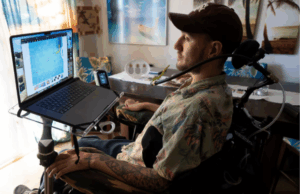 Así es la vida de una persona con un chip cerebral