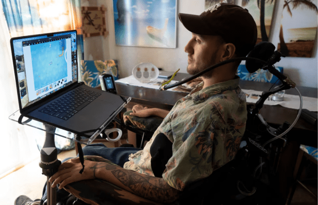 Así es la vida de una persona con un chip cerebral