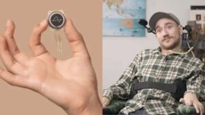 El hombre al que Musk implantó un chip en el cerebro muestra como está 18 meses después: «no debería ser posible…»