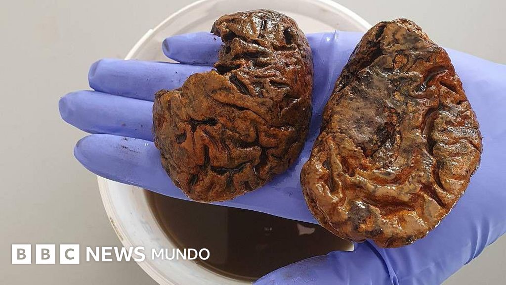 La científica que colecciona cerebros de miles de años de antigüedad y busca desentrañar sus misterios