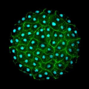 La maravillosa red microscópica que sostiene la vida en los océanos