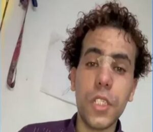 MP investiga agresión a joven con autismo