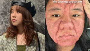 Mujer retrató el cambio físico extremo que tuvo antes, durante y después de su e