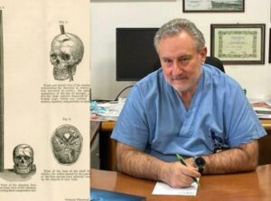 Pasó dos días en su casa con una flecha clavada en la cabeza y vivió para contarlo