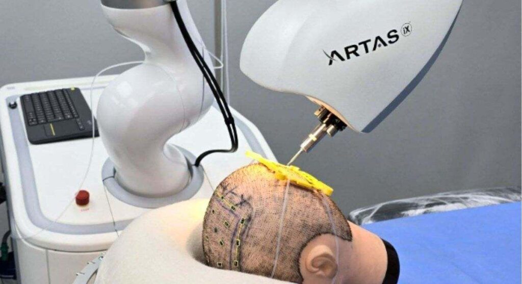 así es ARTAS iX, el robot que te devuelve el pelo