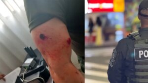 comandante operativo de Policía Antioquia resultó herido en una asonada