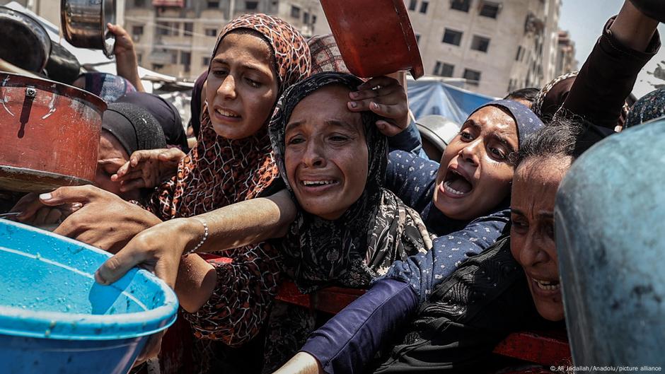 fotos de la hambruna en Gaza no son montajes – DW – 17/08/2025