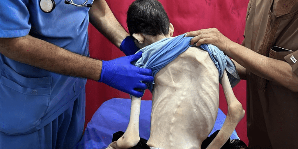 lo que contienen las polémicas cajas de ayuda en Gaza y por qué no resuelven la crisis