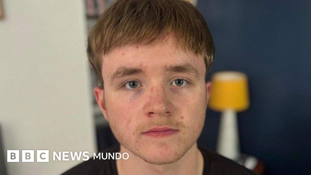 "Comencé a perder mi cabello a los 16 años y eso cambió mi vida por completo"