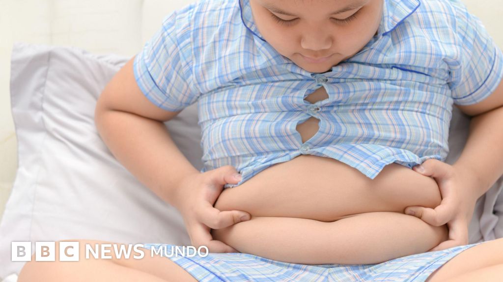 En el mundo hay más niños con sobrepeso que con bajo peso por primera vez en la historia: ¿cuál es la situación en América Latina?