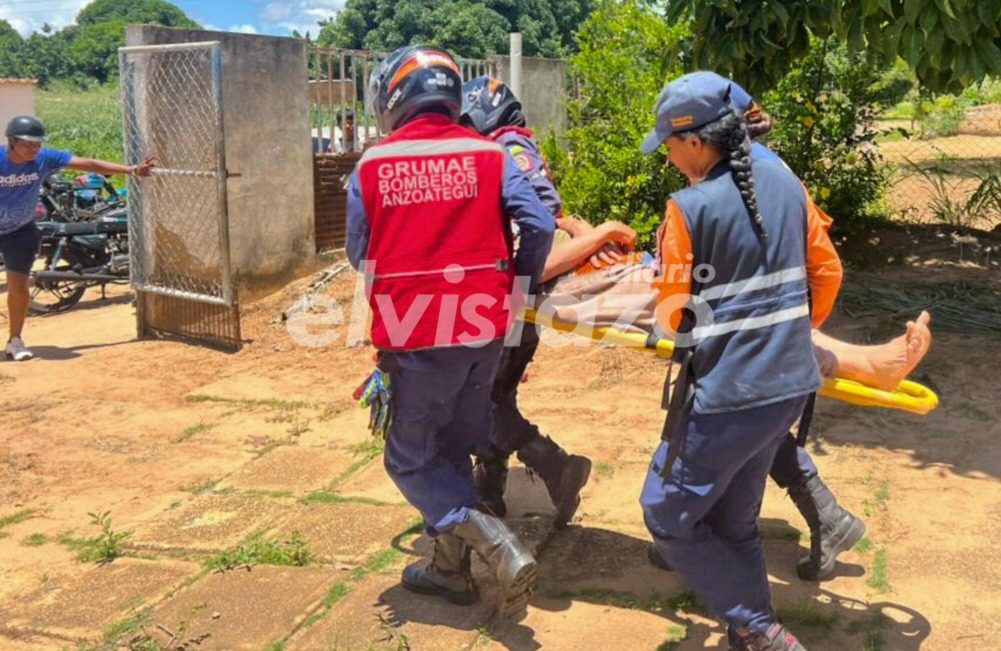 Hombre de 50 años de edad se lesionó al caer de una mata de coco en Guanipa