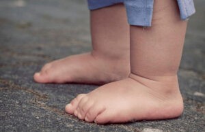 Niña de 2 años murió tras ser arrollada accidentalmente por su padre en Lara