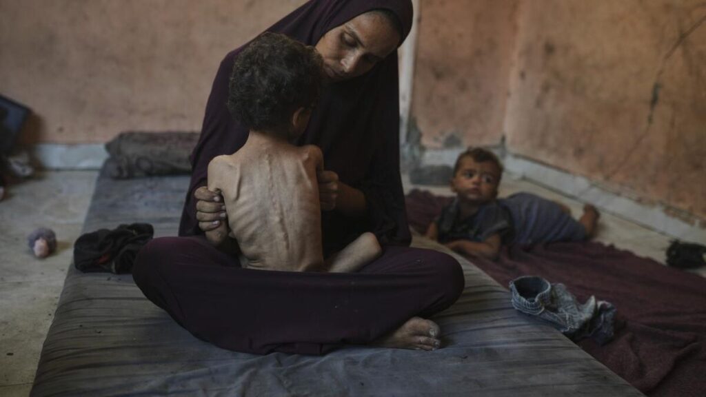 al menos 21.000 niños quedaron discapacitados desde el comienzo la guerra