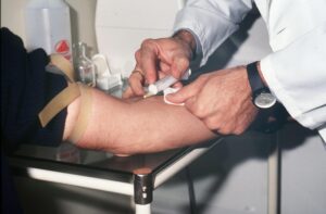 Análisis genético podría detectar el párkinson antes de los primeros síntomas