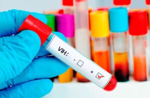 Autoridades sanitarias registraron un alarmante aumento de VIH y sida en pueblos indígenas de Perú