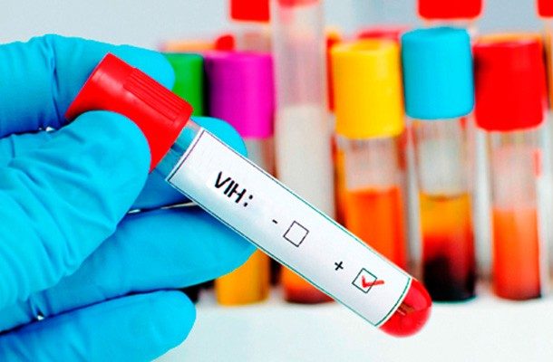 Autoridades sanitarias registraron un alarmante aumento de VIH y sida en pueblos indígenas de Perú