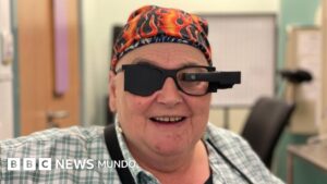 El innovador implante ocular que ayuda a pacientes ciegos a volver a leer