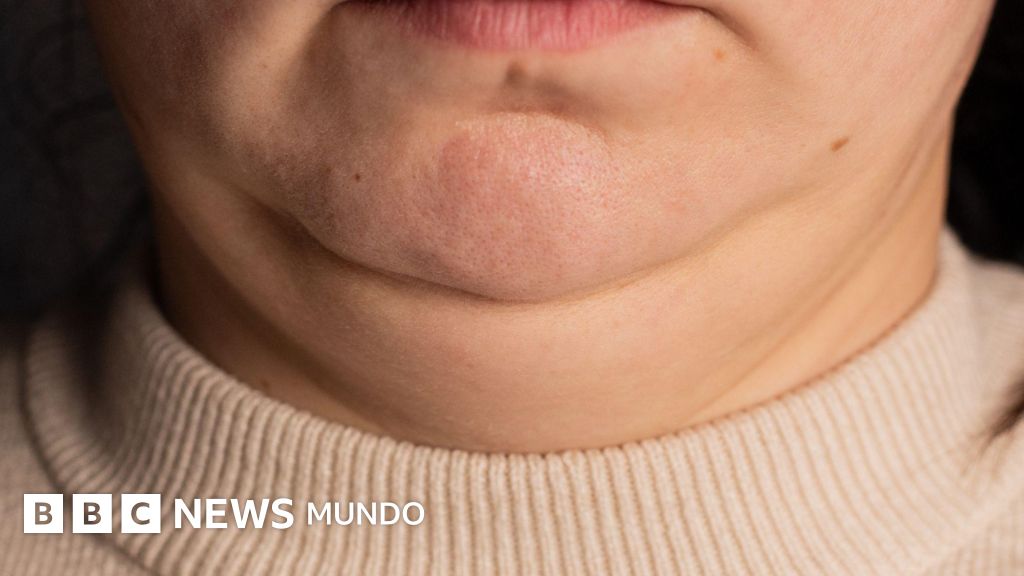 Lo que el tamaño de tu cuello puede revelar sobre tu salud