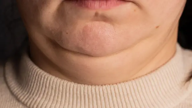 Lo que el tamaño de tu cuello puede revelar sobre tu salud