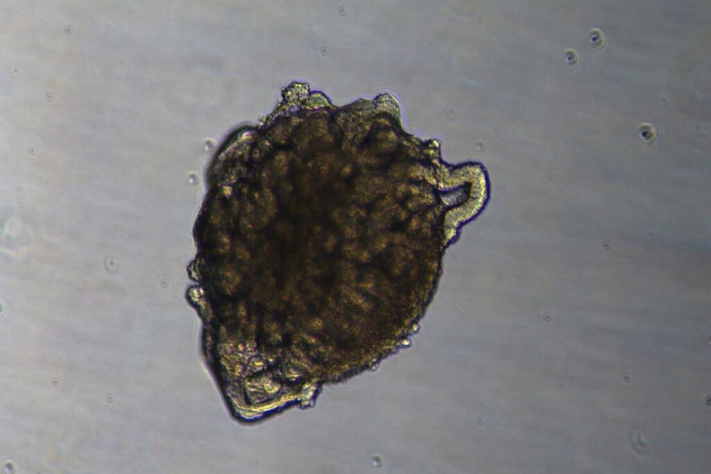 Realizan el primer trasplante en un cerdo de riñones modificados con organoides renales humanos