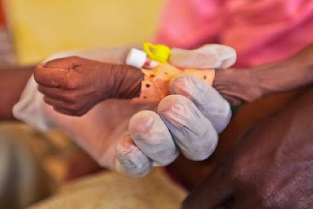 Cáritas alerta sobre niveles críticos de desnutrición infantil en Venezuela