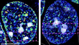 Dos “guardianes epigenéticos” protegen la identidad de las neuronas