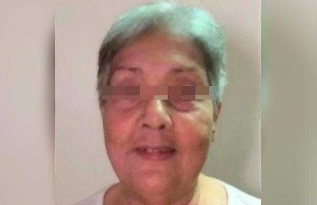 Falleció la señora de 90 años arrollada por un motorizado en Av. Las Ferias de Valencia
