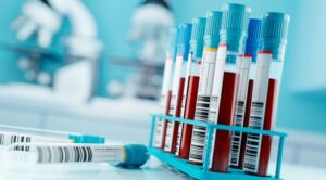 Hallan algo extraño en sangre de pacientes con covid-19