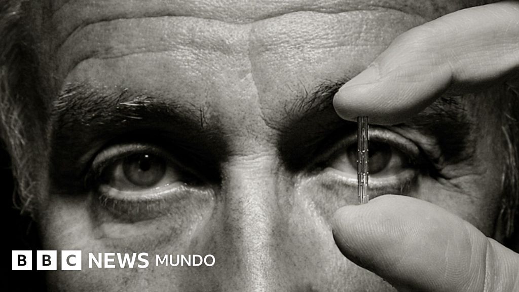 Julio Palmaz, el argentino que revolucionó la cardiología inspirado en una pieza de metal que un albañil olvidó en su casa