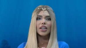 La Barbie colombiana habló de su cirugía más riesgosa y el por qué se la hizo: «Era lo que más me costaba aceptar»