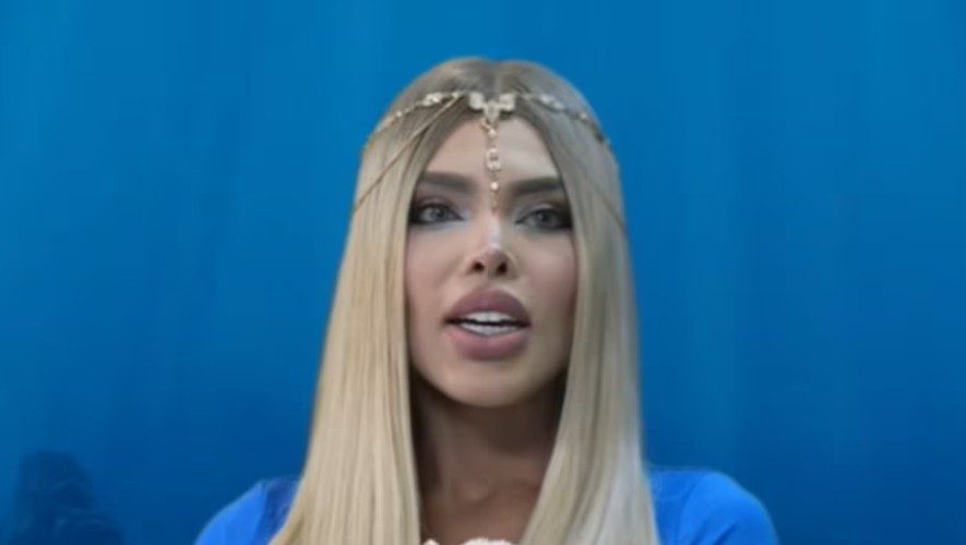 La Barbie colombiana habló de su cirugía más riesgosa y el por qué se la hizo: "Era lo que más me costaba aceptar"
