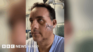 «Me perdonó la vida»: el impresionante relato del mexicano que sobrevivió a la mordida de un tiburón en la cabeza