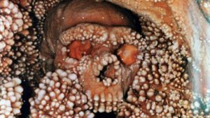 Neandertal de Altamura desvela sus secretos tras 30 años – DW – 19/11/2025