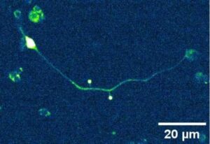 Nuevas pistas sobre cómo se propagan las fuerzas físicas en las neuronas