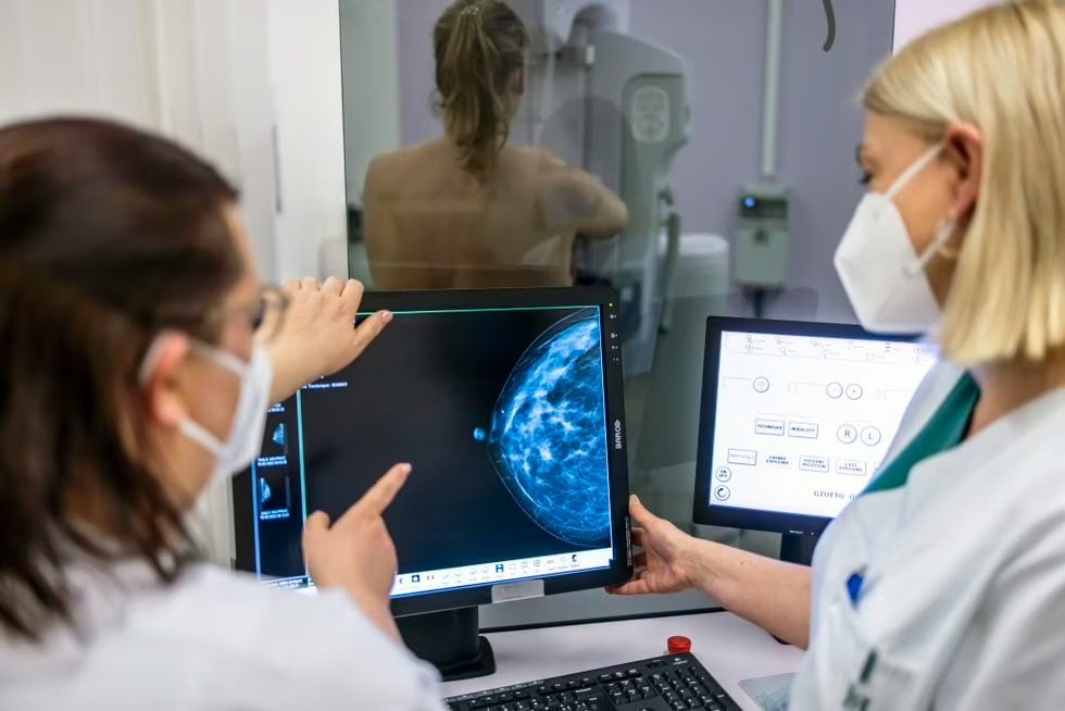 OMS impulsa el diagnóstico en menos de 60 días para reducir mortalidad por cáncer de mama