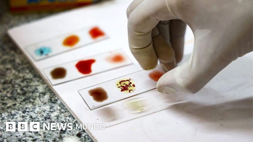 "Sangre dorada": cómo y por qué los científicos están intentando cultivar la sangre más rara del mundo en un laboratorio