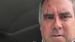 ATENTADO PERÚ | El candidato presidencial peruano Rafael Belaúnde sobrevive a un atentado tras ser tiroteado en su vehículo | elperiodico.com