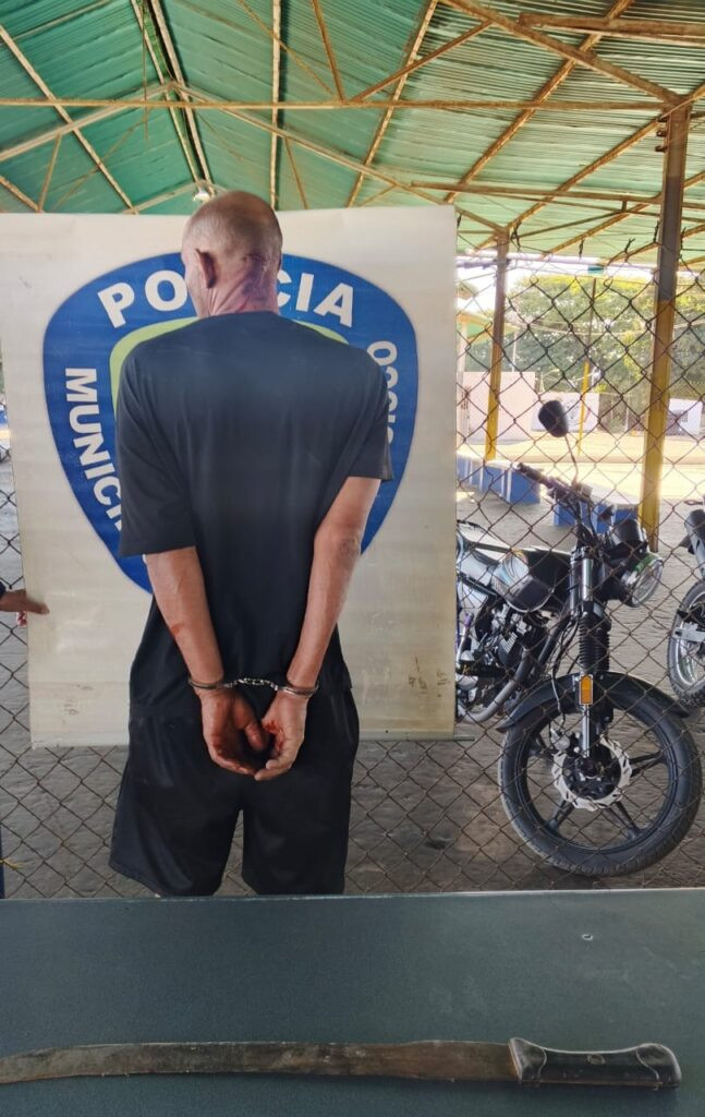 Agrede a un hombre con un machete en Zulia - AlbertoNews