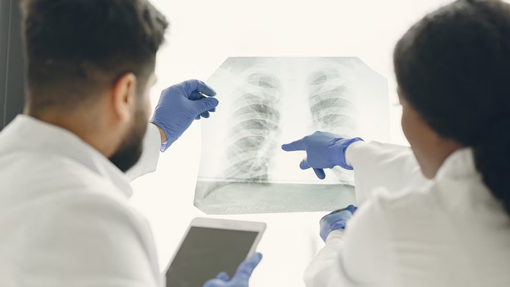 Científicos crean mini pulmones en laboratorio para agilizar la investigación de enfermedades respiratorias - AlbertoNews