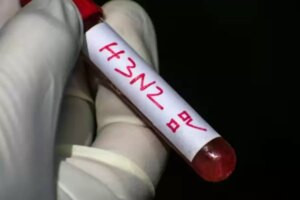 Confirman primer caso de influenza AH3N2 en Colombia