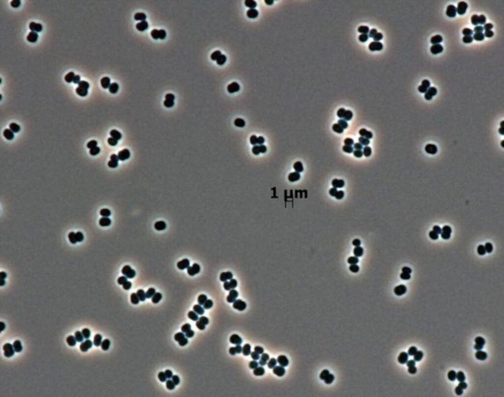 La NASA detectó una bacteria que “finge estar muerta” y podría haber llegado a Marte | National Geographic