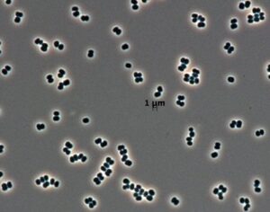 La NASA detectó una bacteria que “finge estar muerta” y podría haber llegado a Marte | National Geographic