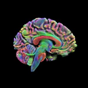 Los científicos identifican cuatro puntos de inflexión clave para el cerebro a medida que envejecemos | National Geographic
