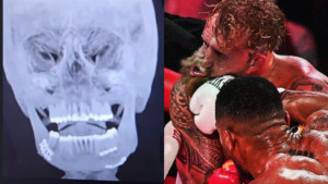 Video del momento en el que Anthony Joshua noquea a Jake Paul y le fractura la mandíbula