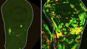el mecanismo que permite la regeneración… y la reaparición del cáncer