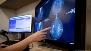 la IA revela lo invisible para los médicos – DW – 02/12/2025